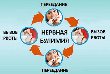 Лечение булимии в Локомотивном